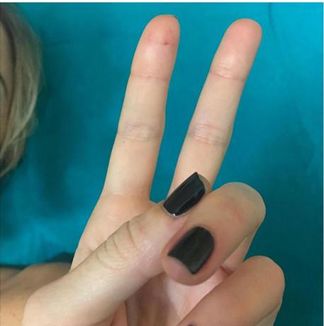 Nadia Toffa delle Iene: "Bella botta ma tengo duro e torno presto"