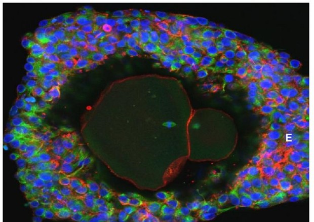Ovociti umani coltivati in provetta, sono i primi