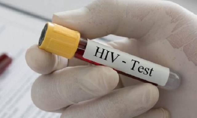 Messina, nasconde hiv e contagia almeno 4 donne