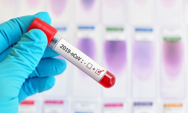 Ad oggi 1260 casi in Sicilia (96 in più di ieri): 33 morti, 36 guariti