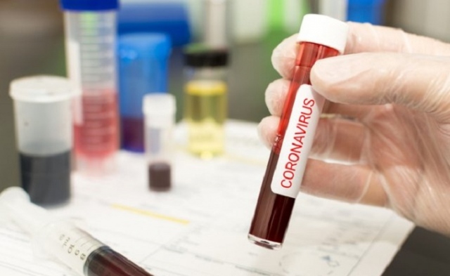 Coronavirus, 721 casi in Sicilia (91 in più di ieri): 13 morti