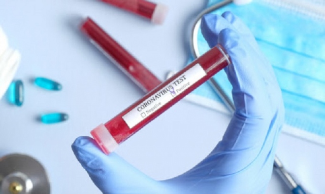 Siracusa, 19 i casi di Coronavirus nel capoluogo: raddoppiati i posti letto in Rianimazione e Malattie infettive