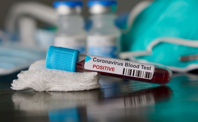 Noto, Coronavirus: 7 pazienti tornano a casa, 3 ancora in ospedale