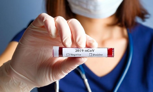 coronavirus-provetta-55r4