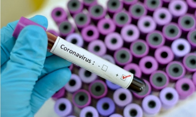 Coronavirus, In Sicilia attuali positivi 1.664 (+58 rispetto a ieri)