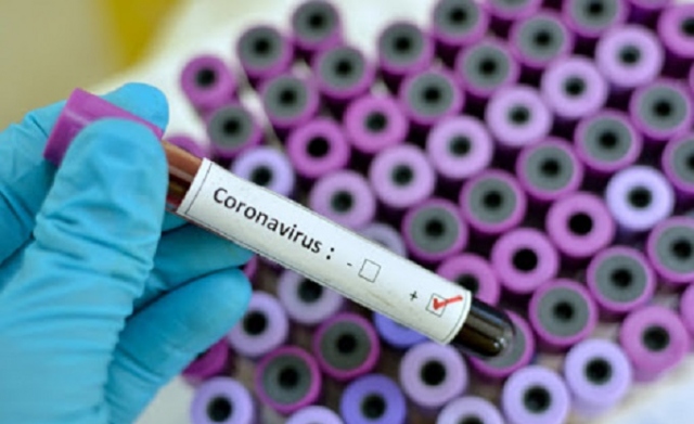 Coronavirus, in Sicilia scende il numero dei ricoverati