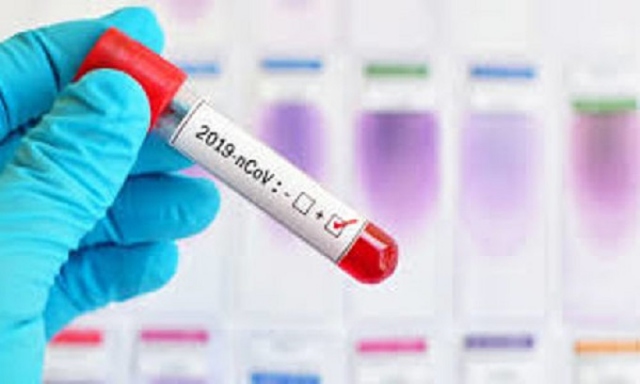 Coronavirus, a Siracusa i casi calano: da 109 a 53 positivi