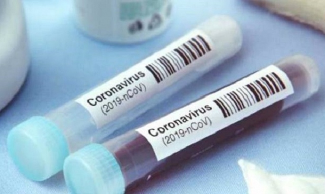 Coronavirus, in Sicilia contagi stabili: meno ricoveri e più guariti