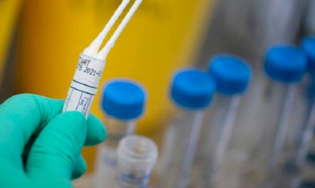 Coronavirus, in Sicilia 2 nuovi positivi, ma è boom di guariti