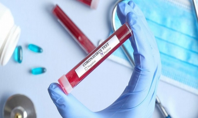 Coronavirus, a Siracusa c'è un nuovo caso positivo: è una donna