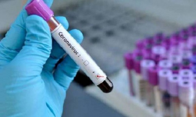 In Sicilia 29 nuovi contagi da coronavirus