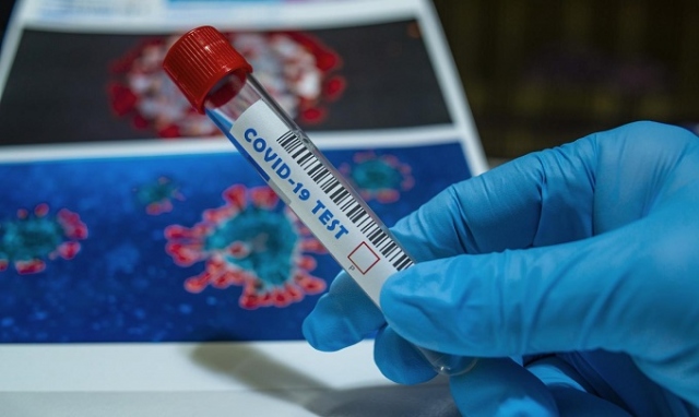 Coronavirus, in Sicilia 10 nuovi positivi