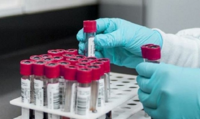 Coronavirus, altri 4 positivi tra Siracusa e provincia. In tutta la Sicilia sono 37