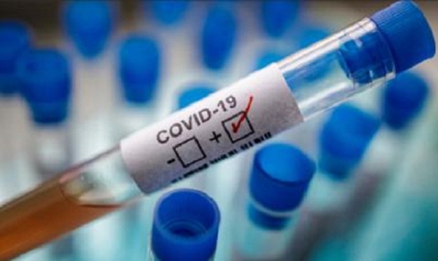 Coronavirus, a Siracusa e provincia sono 4 i nuovi positivi