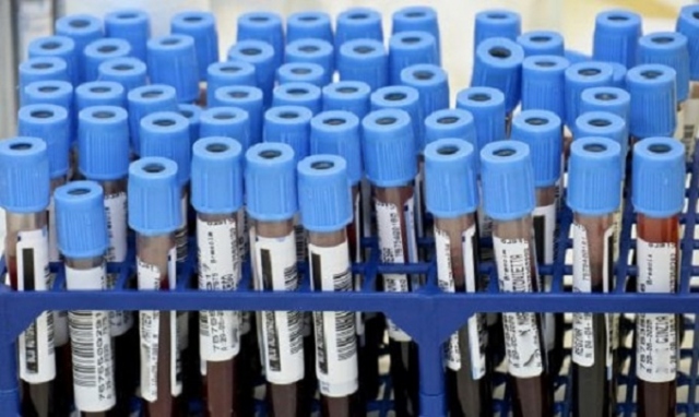 Coronavirus, 21 nuovi positivi in Sicilia