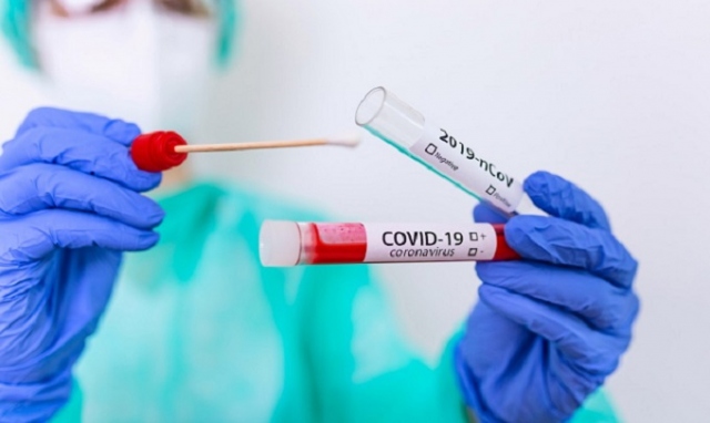 Coronavirus, 35 nuovi positivi in Sicilia. In provincia di Siracusa altri 2 casi