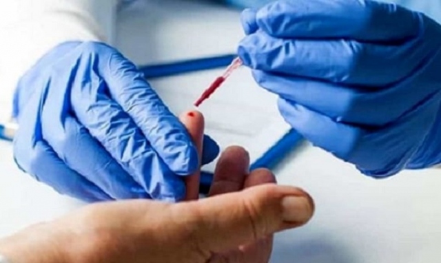 Siracusa e provincia, test sierologici al personale della scuola: da domani la distribuzione dei kit ai medici