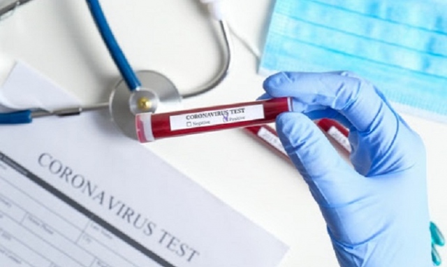 Coronavirus, in provincia di Siracusa 2 nuovi positivi. In Sicilia 33