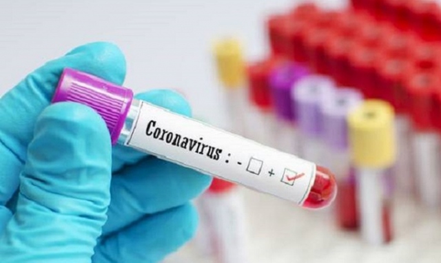 Coronavirus, a Siracusa e provincia 2 nuovi positivi. In Sicilia sono 34