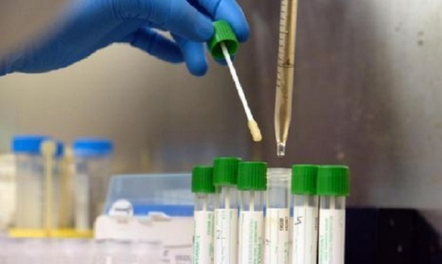 Coronavirus, in provincia di Siracusa un nuovo positivo. In Sicilia 84