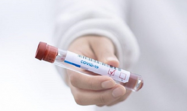 Coronavirus, 7 nuovi positivi in provincia di Siracusa. Sono 33 in Sicilia, 5 sono migranti