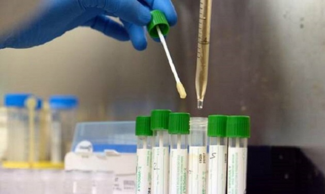 Coronavirus, 4 nuovi positivi in provincia di Siracusa. In Sicilia 110