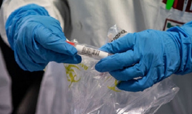 Coronavirus, 3 nuovi positivi in provincia di Siracusa. In Sicilia 125