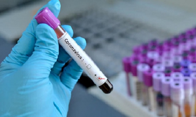 Coronavirus, 1 nuovo positivo in provincia di Siracusa. In Sicilia 107