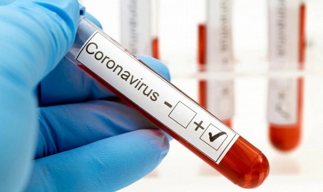Coronavirus, 27 nuovi positivi in provincia di Siracusa. In Sicilia sono 285