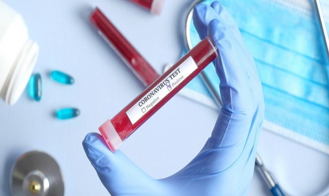 Siracusa, Fp Cisl: "Un piano Marshall per evitare la diffusione del covid tra sanitari"