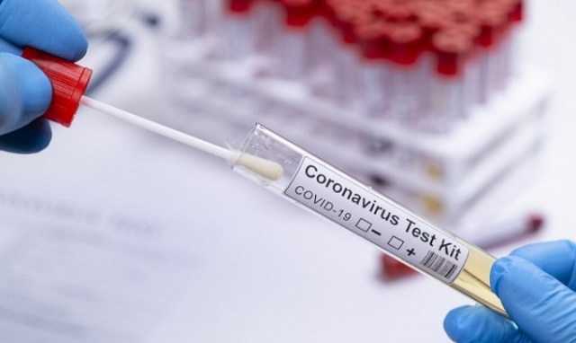 Coronavirus, in provincia di Siracusa 48 nuovi positivi. In Sicilia 984