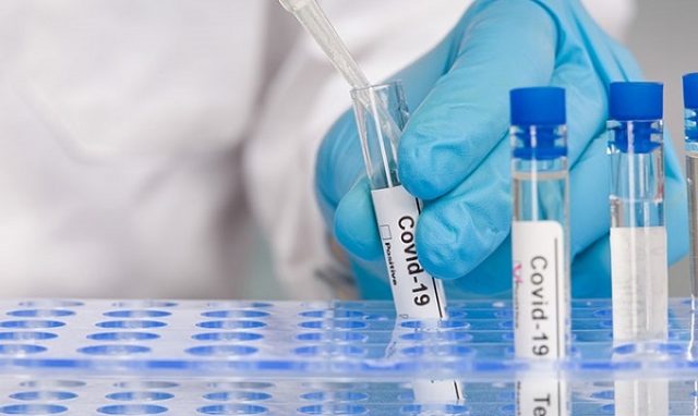 Coronavirus, 20 nuovi positivi in provincia di Siracusa: In Sicilia 562