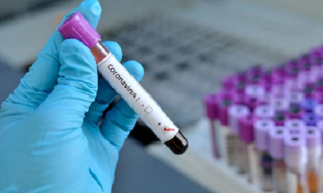 Coronavirus, 114 nuovi positivi in provincia di Siracusa. In Sicilia 1692