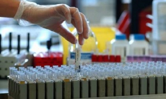 Palermo, interdizione per laboratorio: truffa all'Asp