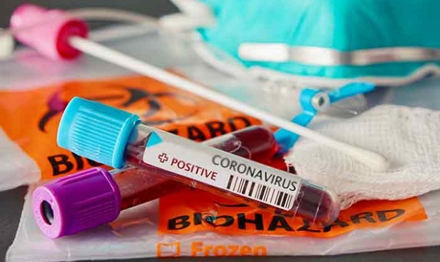 Coronavirus, cala la curva dei contagi: 55 nuovi positivi in provincia di Siracusa
