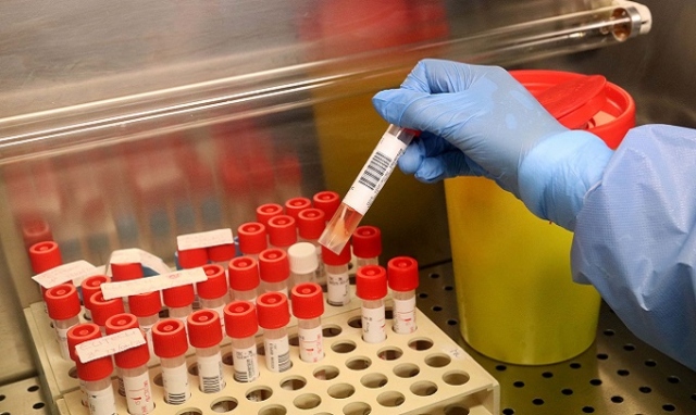 Coronavirus, 79 nuovi positivi a Siracusa e provincia. In Sicilia 1.461