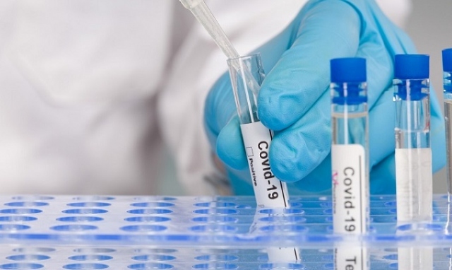 Coronavirus, 89 nuovi positivi a Siracusa e provincia. In Sicilia 1.707