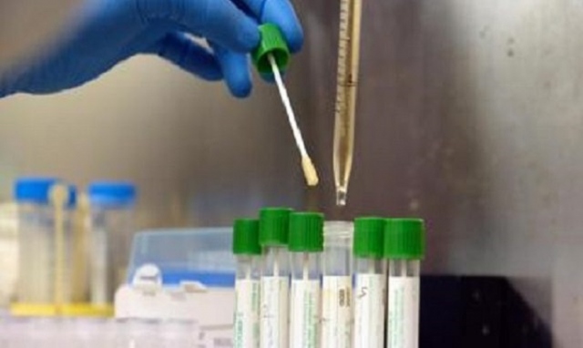 Siracusa, contagi in un centro di riabilitazione: positivi 2 operatori