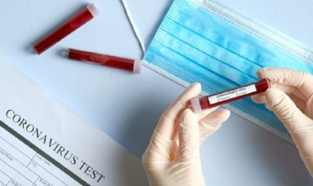 Coronavirus, 39 nuovi positivi in provincia di Siracusa. In Sicilia 669