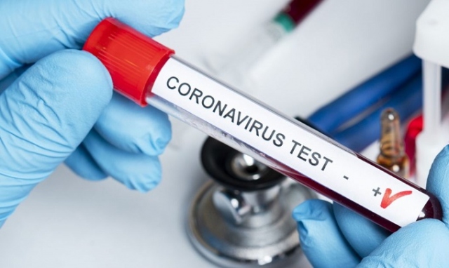 Coronavirus, 42 nuovi positivi in provincia di Siracusa. In Sicilia 720