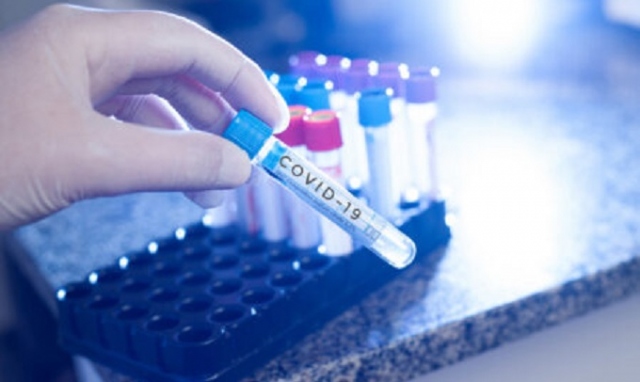 Coronavirus, contagi in calo: 29 nuovi positivi in provincia di Siracusa