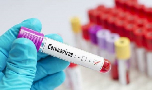 Coronavirus, 157 i nuovi positivi in provincia di Siracusa. In Sicilia 875