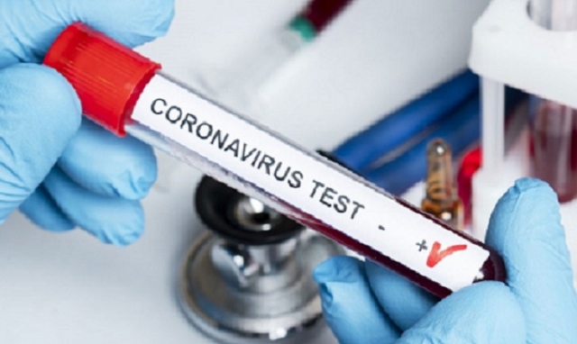 Coronavirus, 107 nuovi positivi in provincia di Siracusa. In Sicilia 1.122