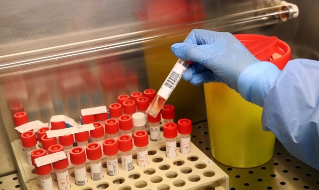 Coronavirus, 55 nuovi positivi in provincia di Siracusa, In Sicilia 478