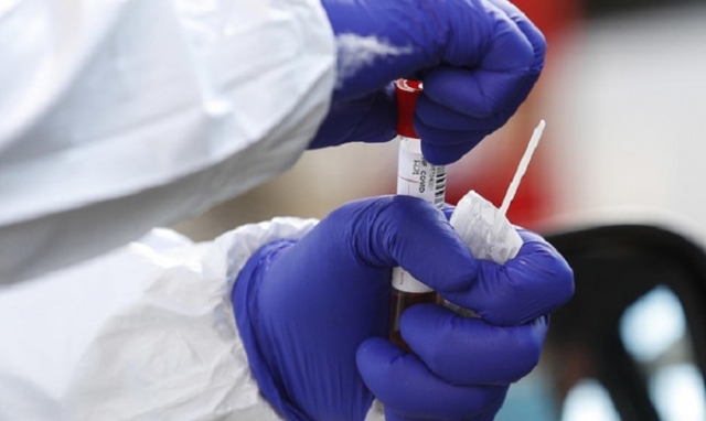 Coronavirus, 123 nuovi positivi in provincia di Siracusa. In Sicilia 1.061