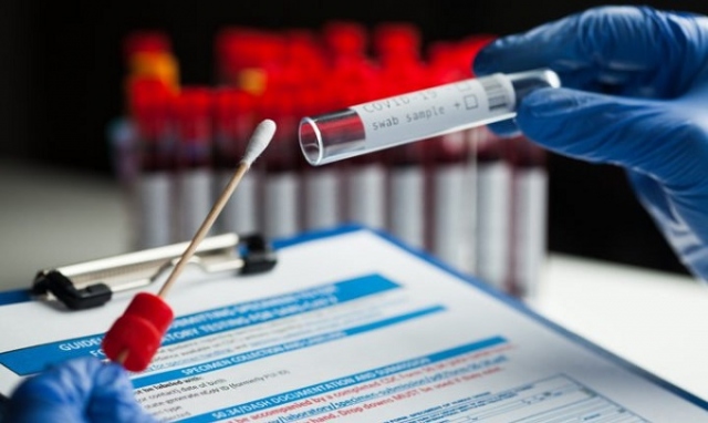 Coronavirus, 106 nuovi positivi in provincia di Siracusa. In Sicilia 1.000