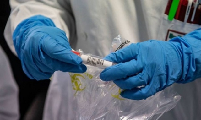 Coronavirus, 35 muovi positivi in provincia di Siracusa. In Sicilia 734