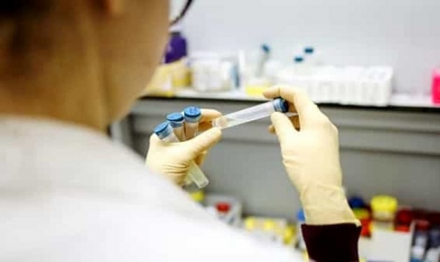 Coronavirus, 5 nuovi positivi in provincia di Siracusa. In Sicilia 119