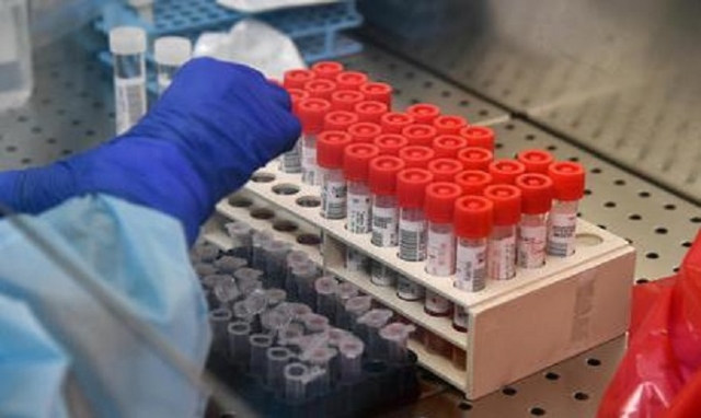 Coronavirus, 24 nuovi positivi in provincia di Siracusa. In Sicilia 337